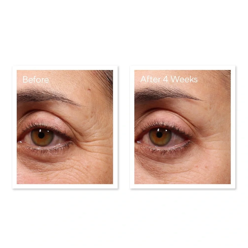 Murad Resurgence Retinol Youth Renewal Eye Serum✨ Anti-Aging Eye Care